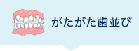 がたがた歯並び
