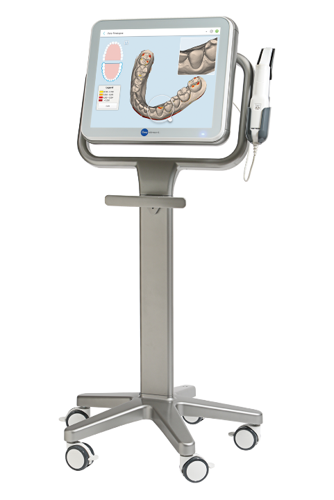 最新機器iTero(アイテロ)